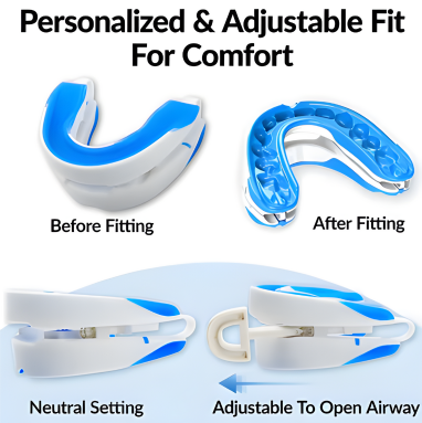 Silent Nights™ Anti-Snore Mouth Guard™
