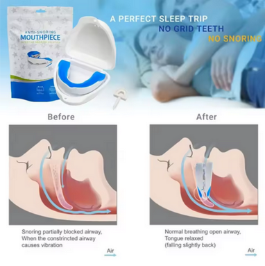 Silent Nights™ Anti-Snore Mouth Guard™
