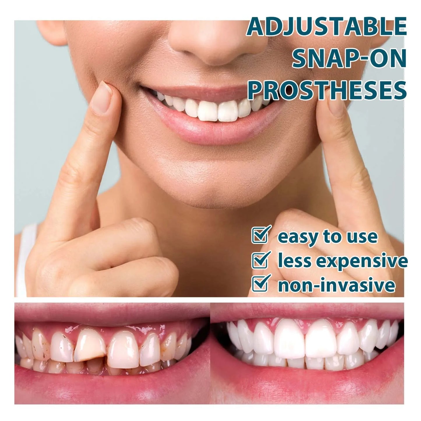 Instant Perfect Smile Snap-On Dentures